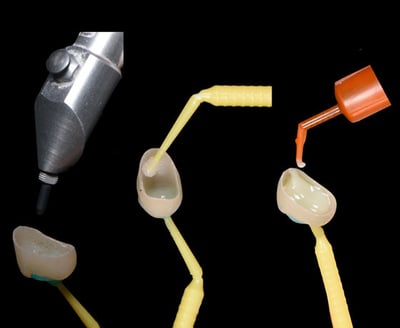 3MOCSD_Blog_Round13_Arcara_RelyXUniversal_560x460_10