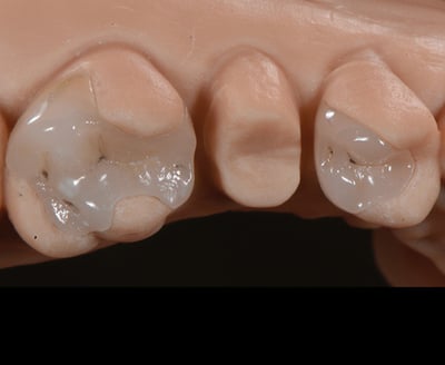 3MOCSD_Blog_Round13_Arcara_RelyXUniversal_560x460_5