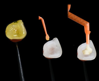 3MOCSD_Blog_Round13_Arcara_RelyXUniversal_560x460_6