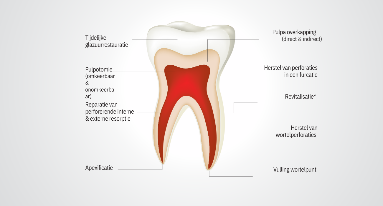 Tooth - septodont-1