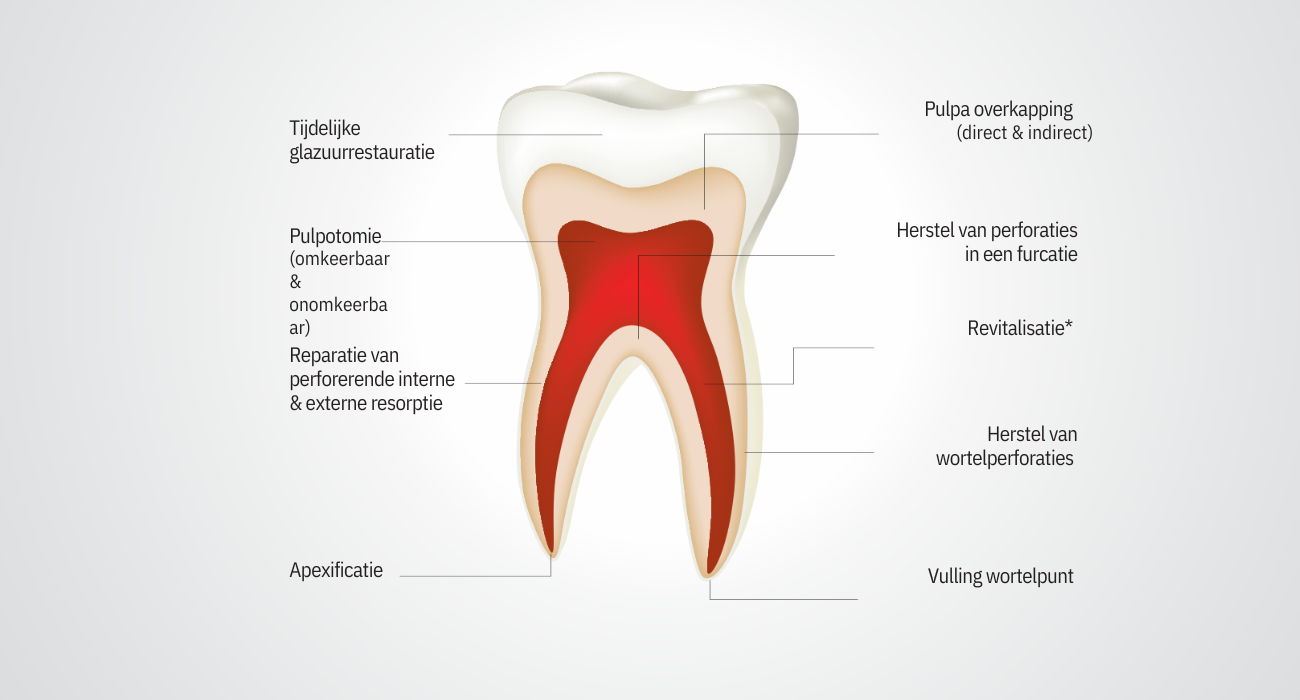 Tooth - septodont-1 Tooth - septodont-1