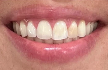 Ultradent- image 1-1