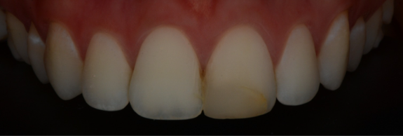 gc_afb1B